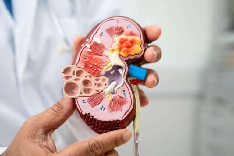 How Ayurvedic Consultation Helps with Kidney Problems in India